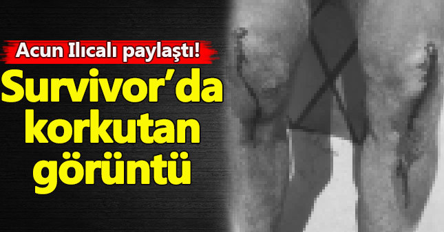 Survivor'da korkutan görüntü!