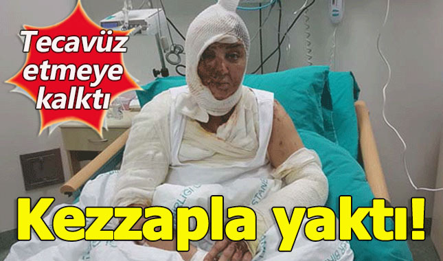 Tecavüz edemediği için kezzapla yaktı