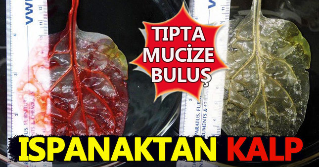 Tıpta tarihi buluş! Ispanaktan kalp yaptılar
