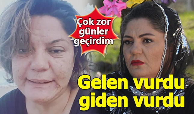 Ünlü sanatçı yıllar sonra itiraf etti: Gelen vurdu giden vurdu