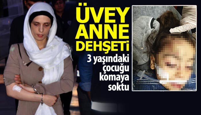 Üvey anne şiddeti, 3 yaşındaki çocuğu komaya soktu