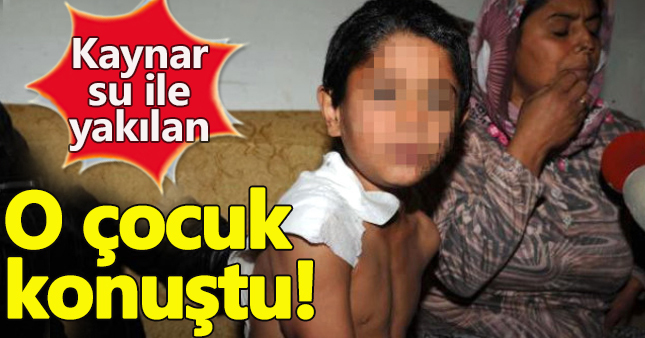 Üzerine kaynar su dökülen çocuk o anları anlattı