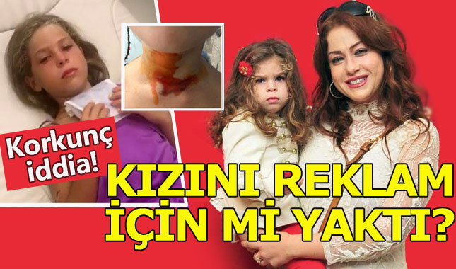 Yeliz Yeşilmen kızını 'reklam için yaktı' iddiası