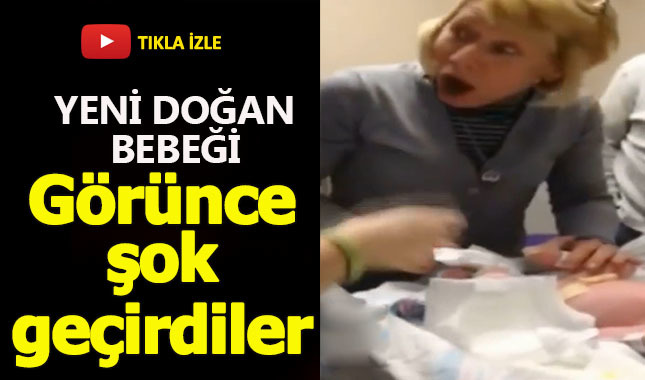 Yeni doğan bebeği görünce şoke oldular!