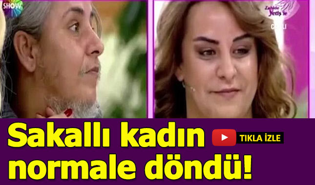 Zahide Yetiş'in programına çıkan sakallı kadın, doğal görünümüne kavuştu