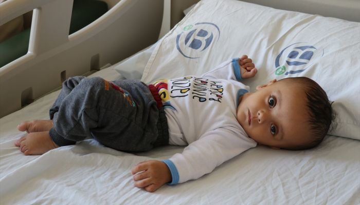 Kağan bebek beynindeki kistin etkisinden şant cihazıyla kurtulacak
