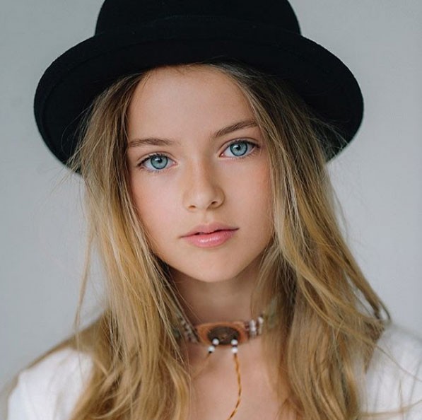 Dünyanın en güzel çocuğunun son hali A24