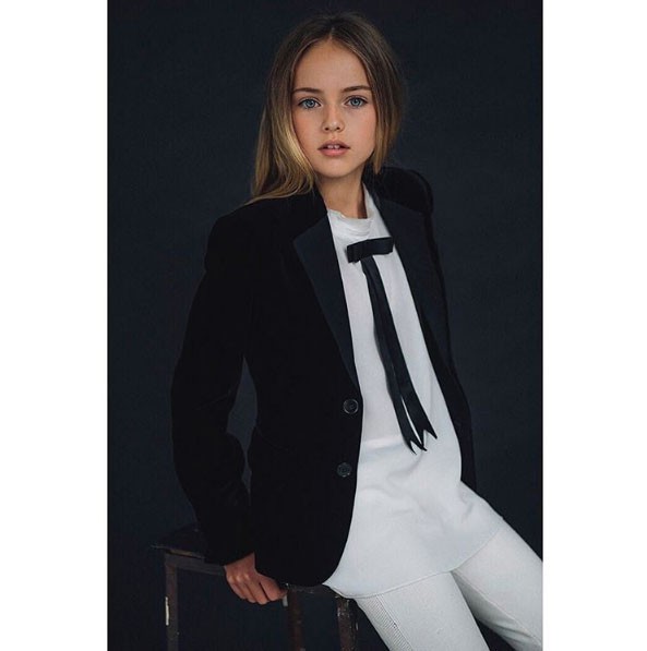 Dünyanın en güzel çocuğunun son hali A24