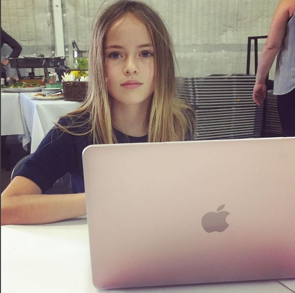 Dünyanın en güzel çocuğunun son hali A24