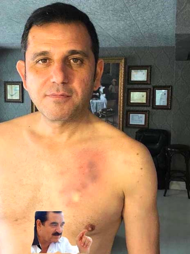 Fatih Portakal'dan Erdoğan dövmesi geldi A24