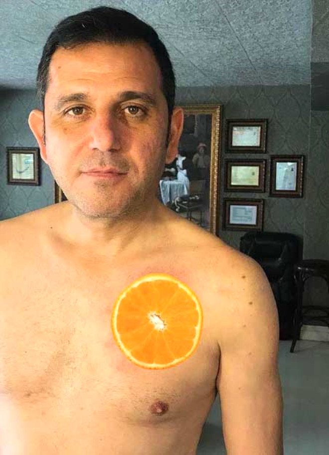 Fatih Portakal'dan Erdoğan dövmesi geldi A24