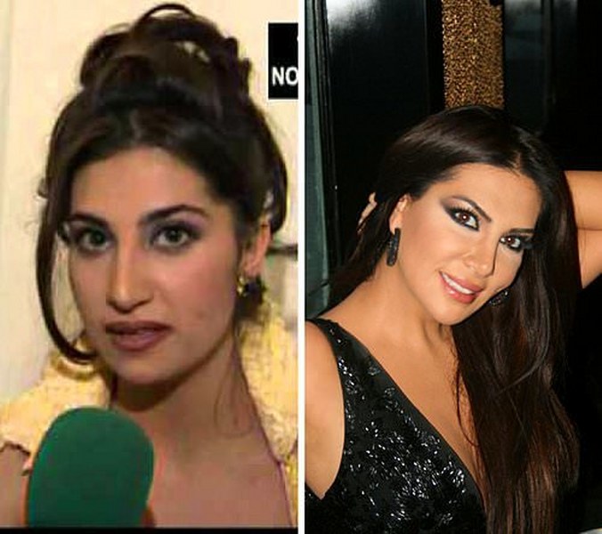 Ünlü isimlerin yıllar içerisindeki inanılmaz değişimleri! A24