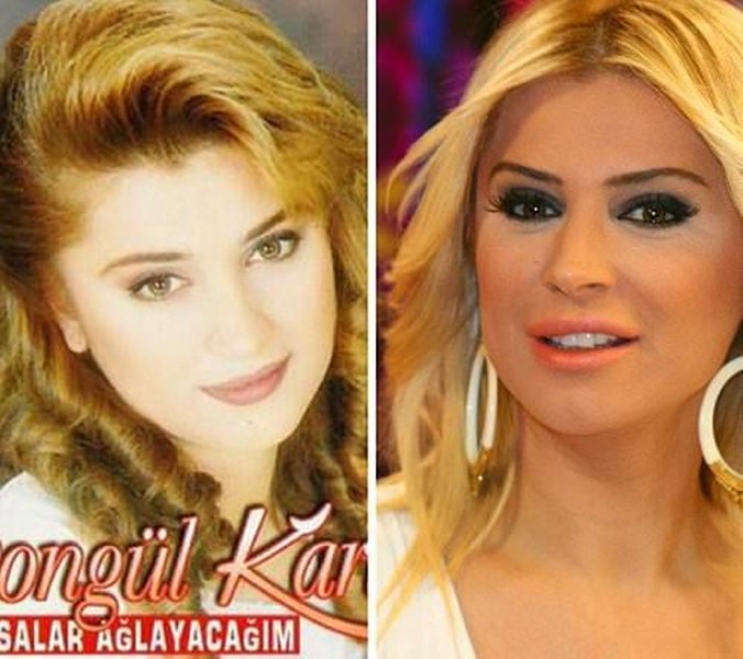 Ünlü isimlerin yıllar içerisindeki inanılmaz değişimleri! A24