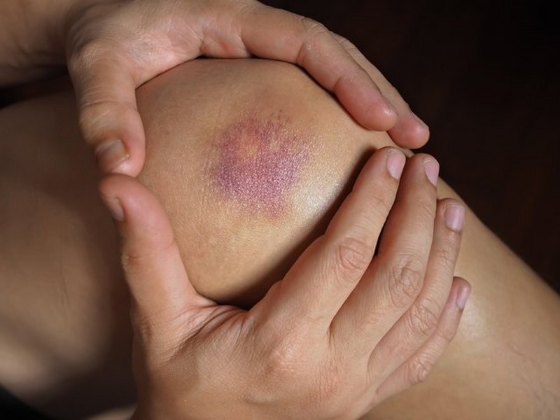 Vitamin eksikliğinin belirtileri nelerdir? A24