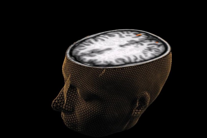 Dünya IQ listesi açıklandı peki sizin IQ'nuz ne kadar? İşte size basit ve kısa bir IQ Testi... A24