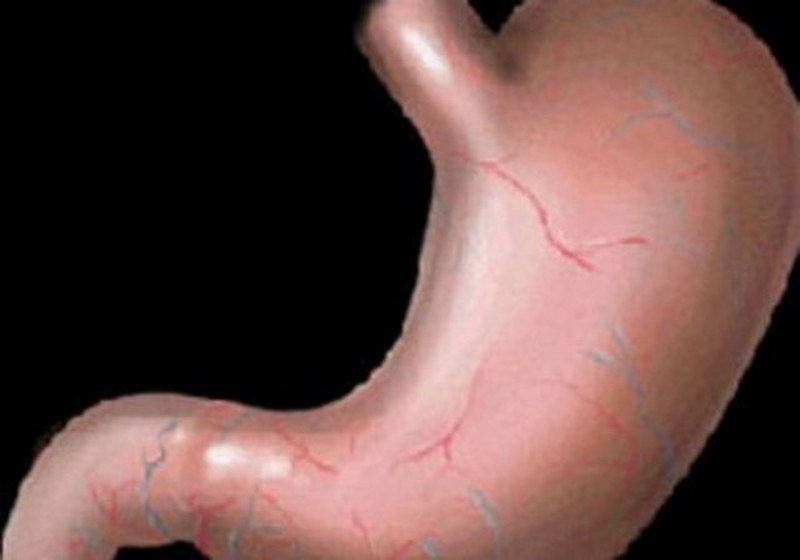 Dünyanın en enteresan bilgileri... A24