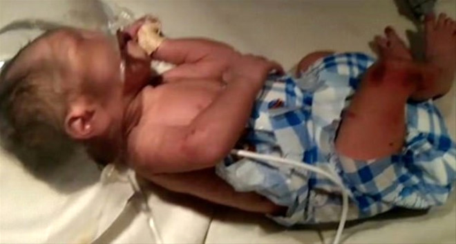 Erkek doğmadı diye bebeği çöpe attılar A24