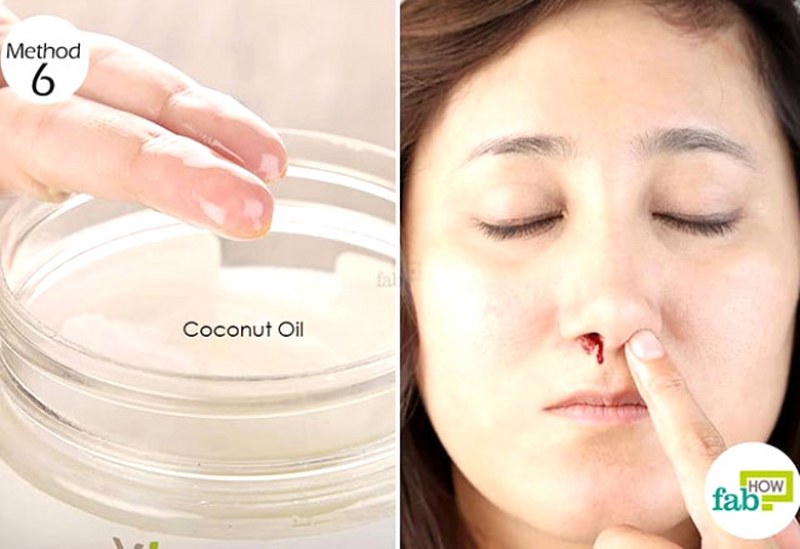 Burun kanamasını 5 dakikada durduran etkili yöntemler A24