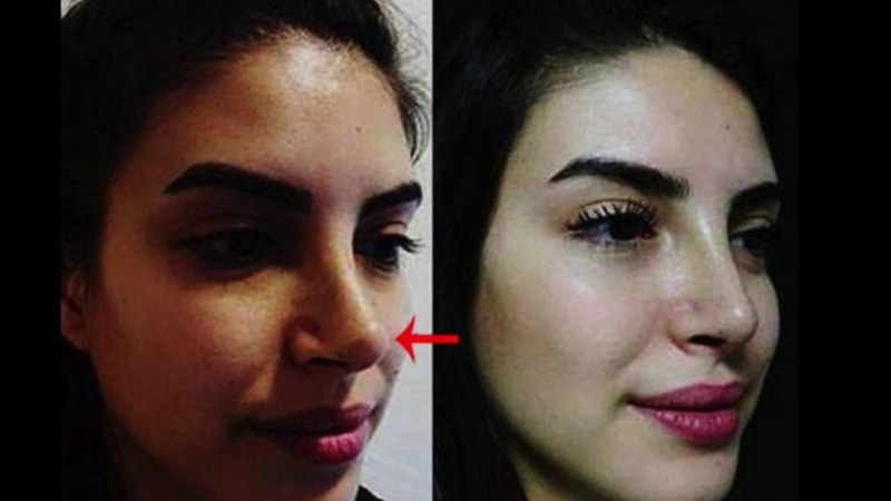 Ünlü isimlerin zaman içerisinde yaşadıkları şaşırtıcı değişimler A24