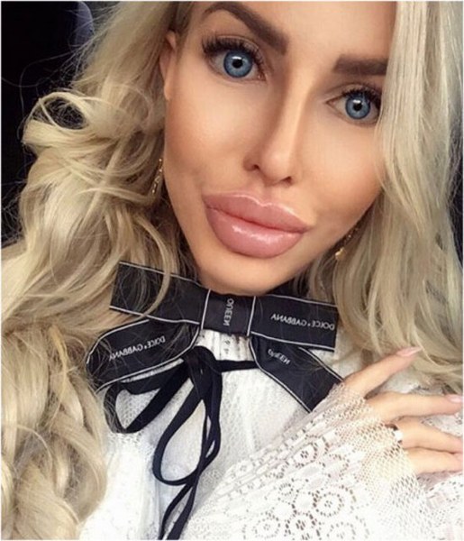 Ona dünyanın en çirkin gelini demişlerdi! Şimdiki hali şaşırttı! A24