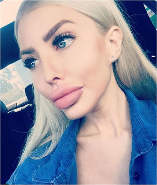 Ona dünyanın en çirkin gelini demişlerdi! Şimdiki hali şaşırttı! A24