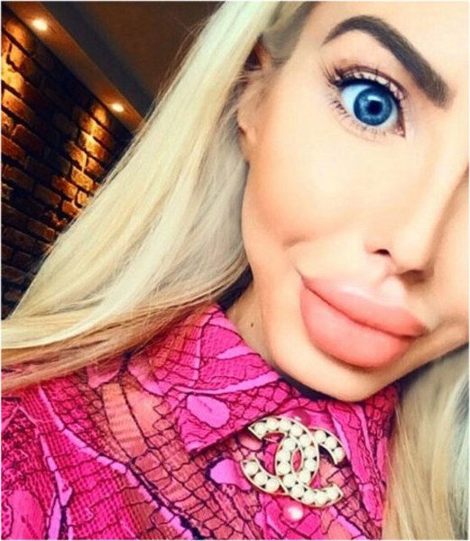 Ona dünyanın en çirkin gelini demişlerdi! Şimdiki hali şaşırttı! A24