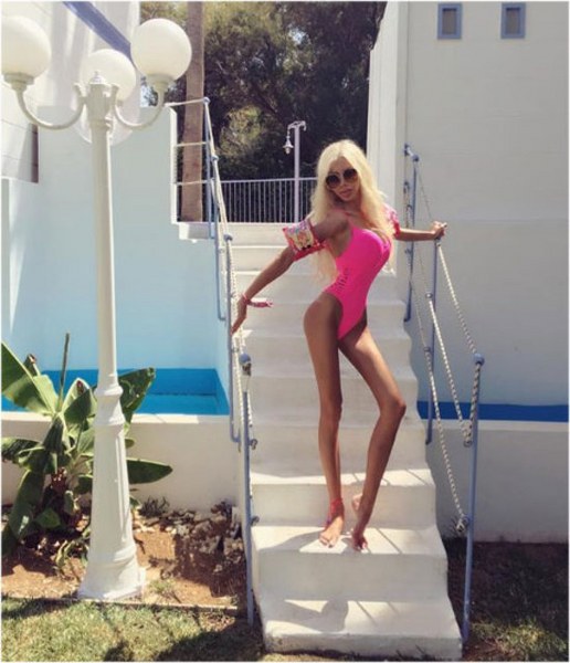 Ona dünyanın en çirkin gelini demişlerdi! Şimdiki hali şaşırttı! A24