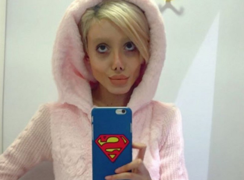 Ona dünyanın en çirkin gelini demişlerdi! Şimdiki hali şaşırttı! A24