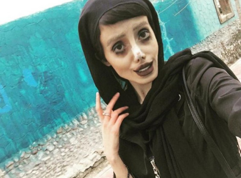 Ona dünyanın en çirkin gelini demişlerdi! Şimdiki hali şaşırttı! A24