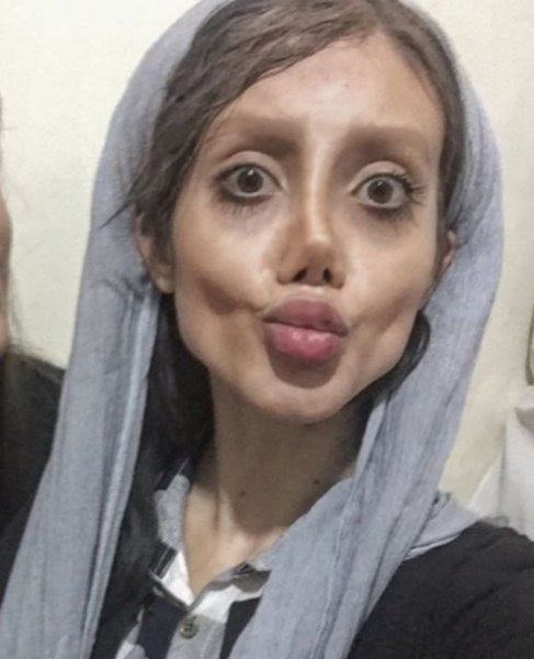 Ona dünyanın en çirkin gelini demişlerdi! Şimdiki hali şaşırttı! A24