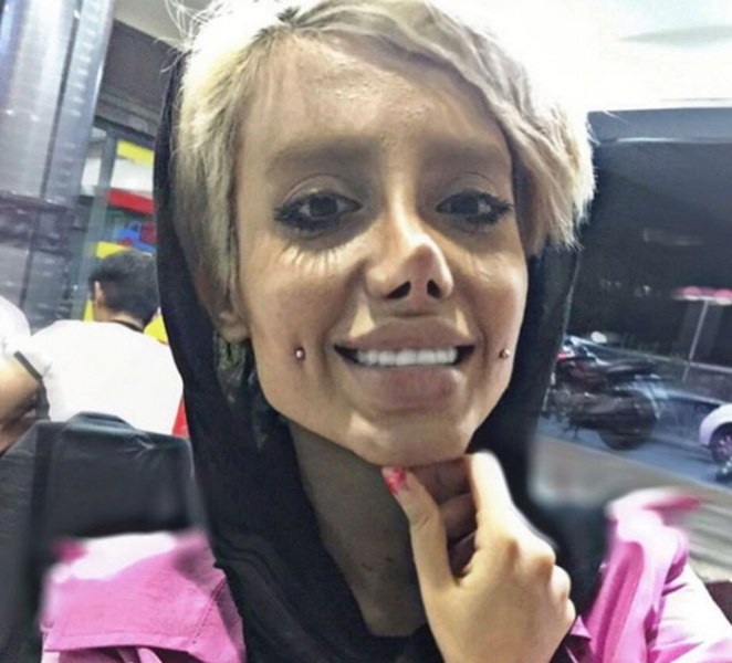 Ona dünyanın en çirkin gelini demişlerdi! Şimdiki hali şaşırttı! A24