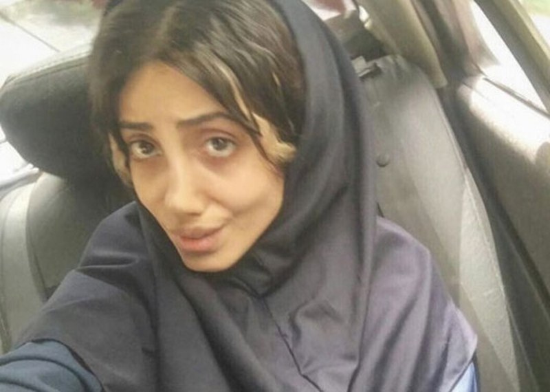 Ona dünyanın en çirkin gelini demişlerdi! Şimdiki hali şaşırttı! A24