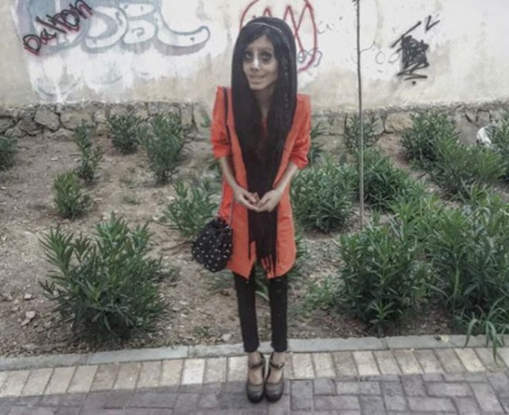 Ona dünyanın en çirkin gelini demişlerdi! Şimdiki hali şaşırttı! A24