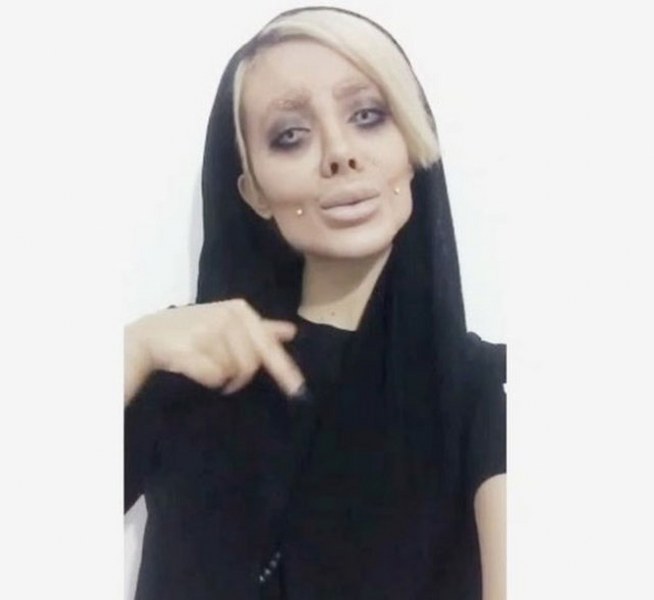 Ona dünyanın en çirkin gelini demişlerdi! Şimdiki hali şaşırttı! A24