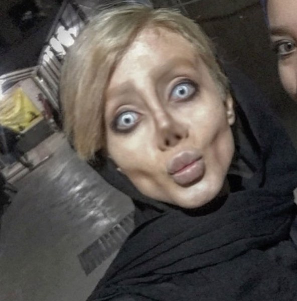 Ona dünyanın en çirkin gelini demişlerdi! Şimdiki hali şaşırttı! A24