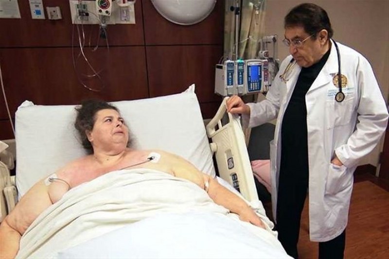 Dr Nowzaradan kimdir TLC yaptırdığı diyete bakın mucize değişim A24