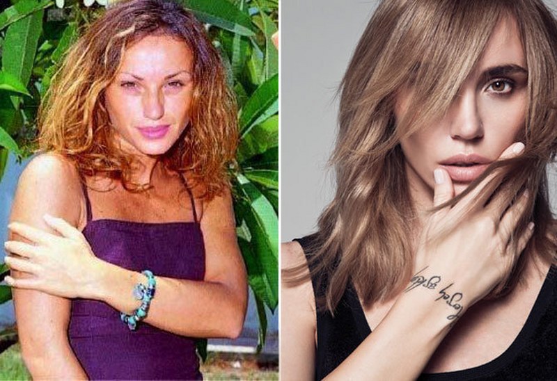 Estetik operasyon geçiren ünlülerin eski ve yeni halleri nasıl? Kim ne estetik yaptırdı? Gözlerinize inanamayacağınız karelerle ünlü isimler! A24