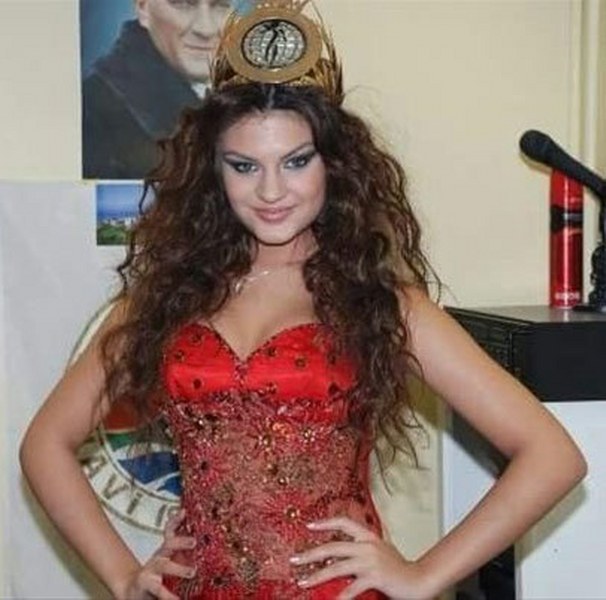 Estetik operasyon geçiren ünlülerin eski ve yeni halleri nasıl? Kim ne estetik yaptırdı? Gözlerinize inanamayacağınız karelerle ünlü isimler! A24