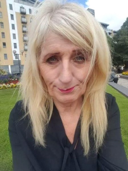 Lotodan çıkan parayı estetiğe yatıran kadın 'insanlıktan' çıktı A24