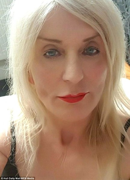 Lotodan çıkan parayı estetiğe yatıran kadın 'insanlıktan' çıktı A24