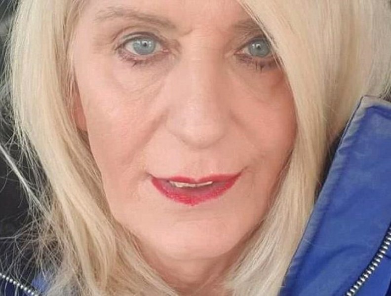 Lotodan çıkan parayı estetiğe yatıran kadın 'insanlıktan' çıktı A24