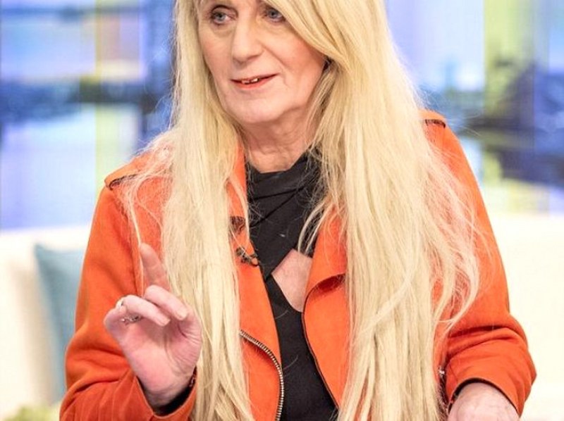 Lotodan çıkan parayı estetiğe yatıran kadın 'insanlıktan' çıktı A24