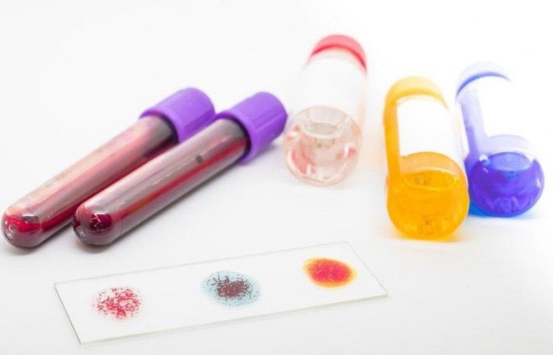 Kan gruplarına göre daha sık yaşanan kanser tipleri A24