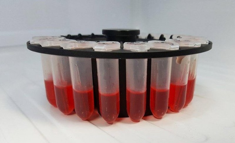 Kan gruplarına göre daha sık yaşanan kanser tipleri A24