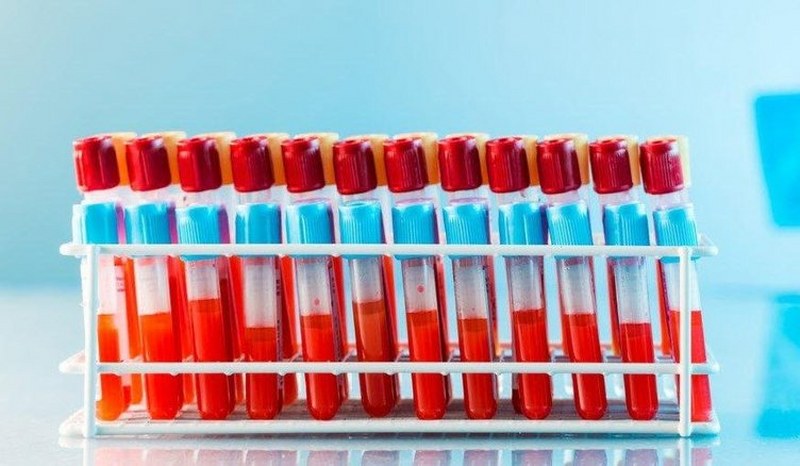 Kan gruplarına göre daha sık yaşanan kanser tipleri A24