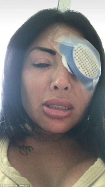 Göz renklerini değiştirmek için kör kalmayı göze alan güzeller! A24