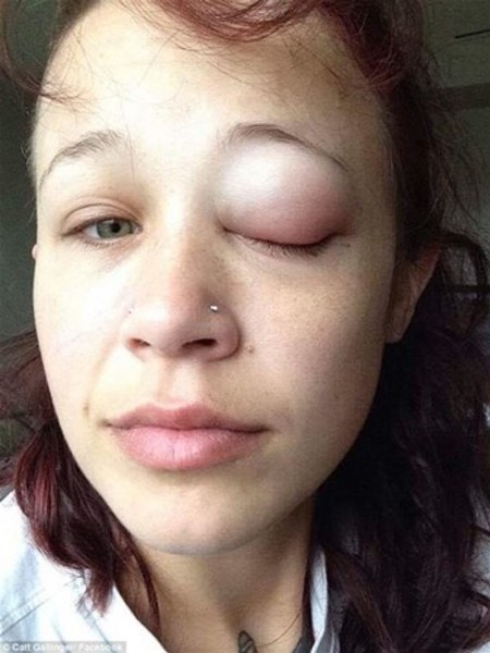 Göz renklerini değiştirmek için kör kalmayı göze alan güzeller! A24