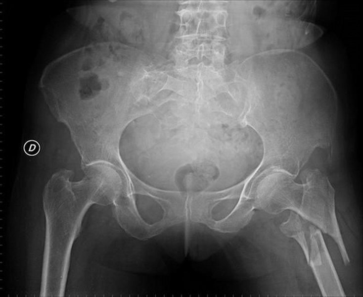 Az kişinin bildiği 24 bilimsel gerçek A24