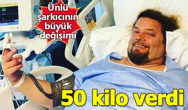Müzisyen İskender Paydaş 2 yılda 50 kilo verdi A24