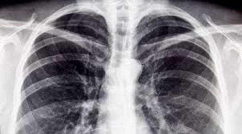 Yanlışlıkla yapılmış 6 önemli icat A24